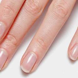 What causes unhealthy nails?