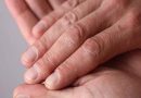 How to diagnose nail psoriasis?