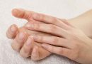 Treating ingrown toenails: All the solutions